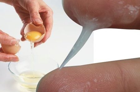 تخمک گذاری بدون ترشح ممکن است
